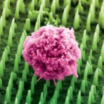 Kolorierte Aufnahme des Nanopatch mit einem Elektronen-Mikroskop: die Nadeln sind tausendmal dünner als ein menschliches Haar.