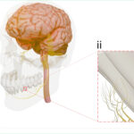 Illustration aus dem Forschungsartikel: Nervengewebe rund um das Implantat.