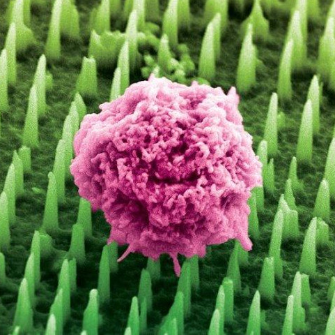 Nano-Nadelpflaster macht OPs überflüssig Nano-Nadelpflaster macht OPs überflüssig