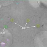 Hemifusome unter dem Mikroskop als blasenartige runde Elemente erkennbar.
