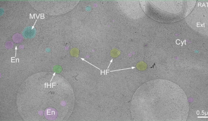 Hallo, Hemifusom! Bisher unbekanntes Zellorganell entdeckt