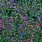 Humane neuronale Stammzellen in Zellkultur