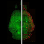 Links: Fluoreszenz-Mikroskopische Aufnahme eines Mausgehirns zwölf Stunden nach Behandlung mit Nanopartikeln, deutlich weniger Ablagerungen zu sehen, Rechts: Aufnahme eines unbehandelten Mausgehirn (Rot: Amyloid-β-Ablagerungen. Grün: Gefäße der Blut-Hirn-Schranke)
