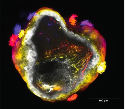 Wenn Zellen denken lernen: Erstmals Bio-Bots mit Nervengewebe im Labor erzeugt